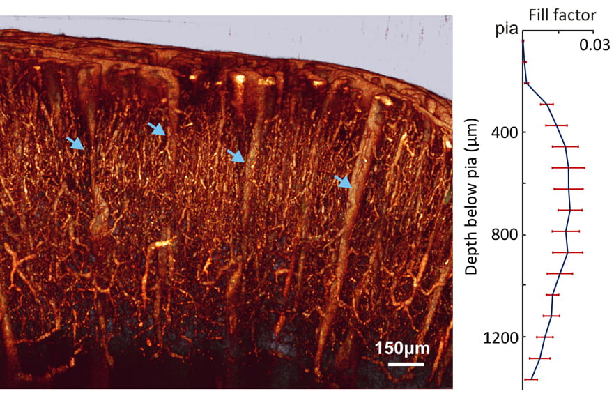 cerebrovasculature sensorimotor cortex
