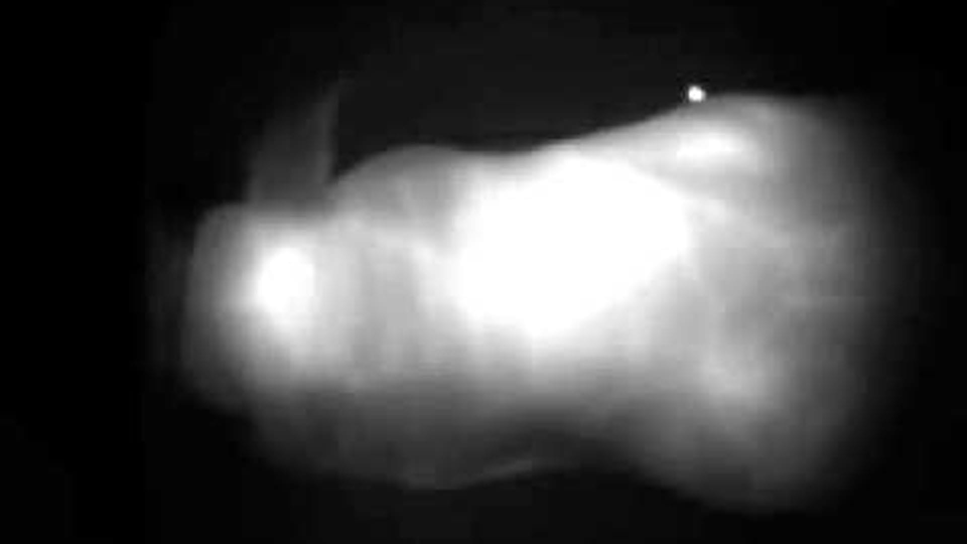 imaging tissue video in SWIR