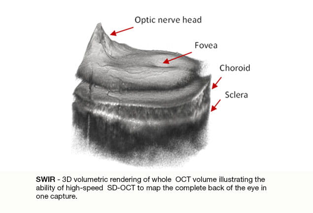 SUI swir 3D volumetric rendering whole eye